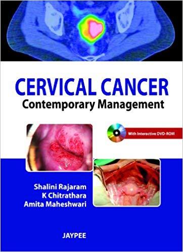Cervical Cancer - Contemporary Management