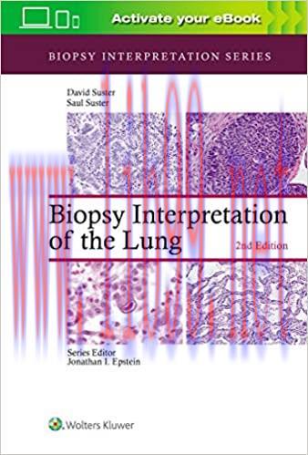 [Html]Biopsy Interpretation of the Lung (Biopsy Interpretation Series) 2nd Edition