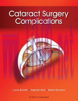 [AME]Cataract Surgery Complications (ORIGINAL PDF from_ Publisher)