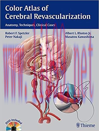 [PDF]Color Atlas of Cerebral Revascularization Anatomy Techniques Clinical Cases PDF+VIDEOS