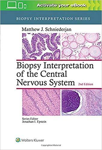 Biopsy Interpretation of the Central Nervous System Second Edition