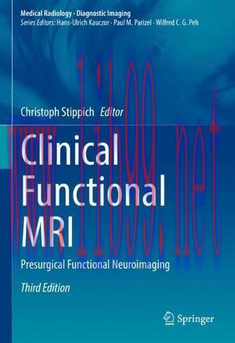 [AME]Clinical Functional MRI: Presurgical Functional Neuroimaging (Medical Radiology), 3rd Edit...