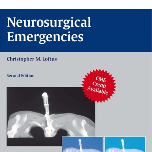 Neurosurgical Emergencies, 2nd Edition