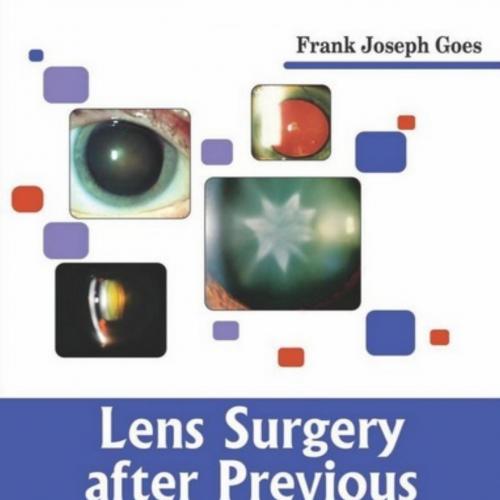 Lens Surgery after Previous Refractive Surgery