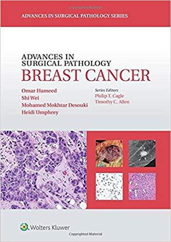 Advances in Surgical Pathology - Breast Cancer, 1st Edition
