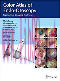 [AME]Color Atlas of Endo-Otoscopy: Examination-Diagnosis-Treatment, 1st edition (EPUB)