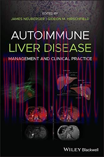 [AME]Autoimmune Liver Disease: Management and Clinical Practice