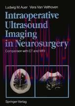 [PDF]Intraoperative Ultrasound Imaging in Neurosurgery: Comparison with CT and MRI