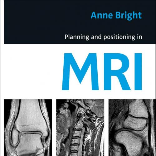 Planning and Positioning in MRI