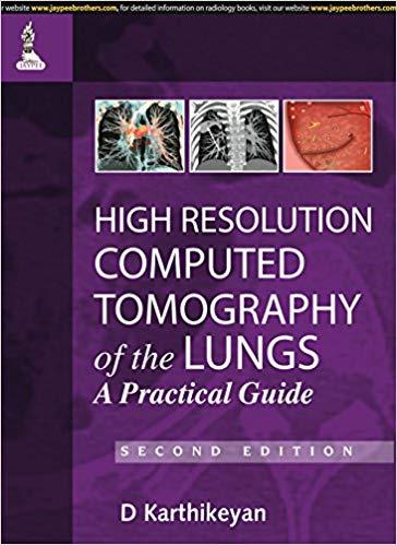 High Resolution Computed Tomography of the Lungs, 2nd Edition
