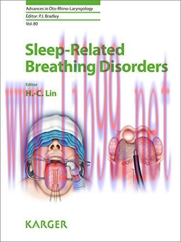 [AME]Sleep-Related Breathing Disorders (Advances in Oto-Rhino-Laryngology, Vol. 80) (Original P...