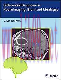 [PDF]Differential Diagnosis in Neuroimaging - Brain and Meninges