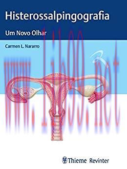 [AME]Histerossalpingografia: Um Novo Olhar (Portuguese Edition) (ePub+azw3+Converted PDF)