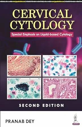[AME]Cervical Cytology: Special Emphasis on Liquid-based Cytology, 2ed (Original PDF)