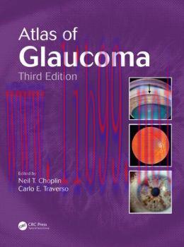 [AME]Atlas of Glaucoma, Third Edition