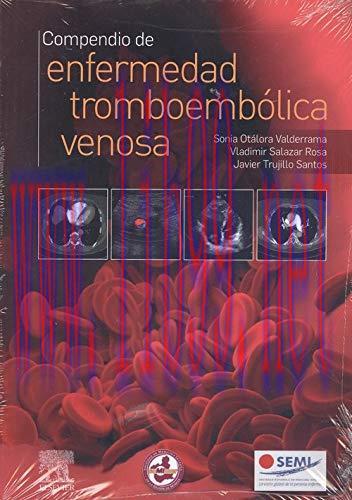[AME]Compendio de enfermedad tromboemb&oacute;lica venosa (Spanish Edition) (Original PDF)