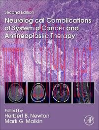 [AME]Neurological Complications of Systemic Cancer and Antineoplastic Therapy, 2nd Edition (EPU...