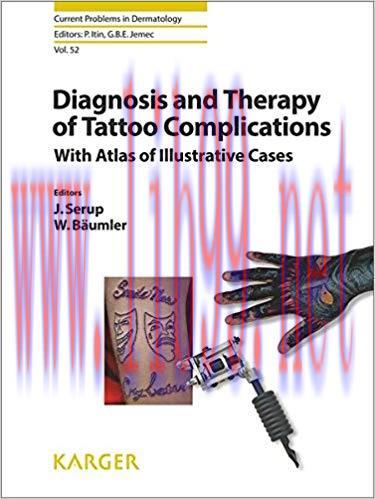 [PDF]Diagnosis and Therapy of Tattoo Complications
