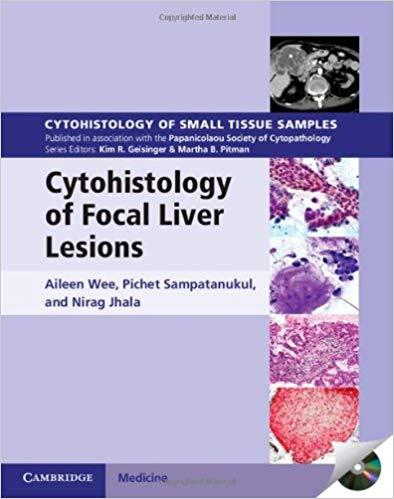 Cytohistology of Focal Liver Lesions