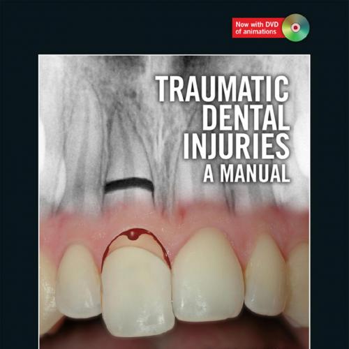 Traumatic Dental Injuries A Manual 3rd - Jens O. Andreasen