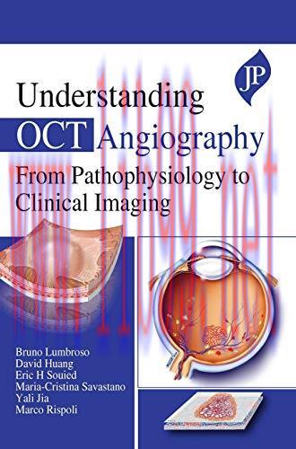 [AME]Understanding OCT Angiography from_ Pathophysiology to Clinical Imaging (Converted PDF)