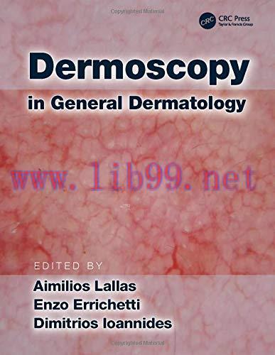 [AME]Dermoscopy in General Dermatology (PDF)