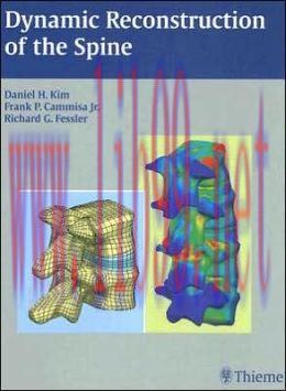 [AME]Dynamic Reconstruction of the Spine