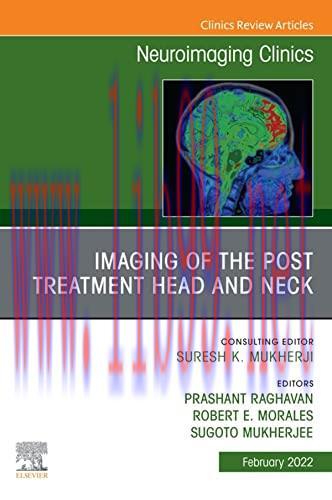 [AME]Imaging of the Post Treatment Head and Neck, An Issue of Neuroimaging Clinics of North Ame...