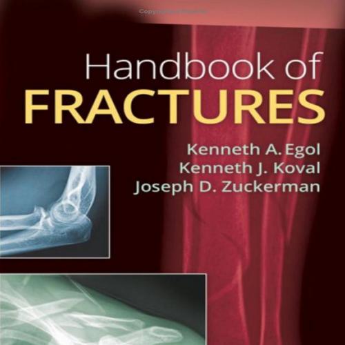 Handbook of Fractures 5th Fifth Edition - Egol, Kenneth & Koval, Kenneth J. & Zuckerman, Joseph