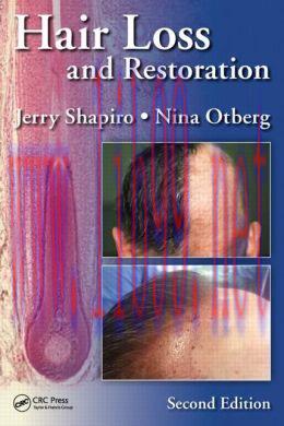 [AME]Hair Loss and Restoration, 2nd Edition
