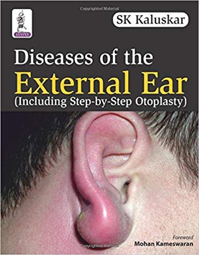 Diseases of the External Ear (Including Step-by-Step Otoplasty)