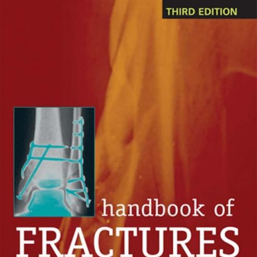 Handbook of Fractures, 3rd Edition