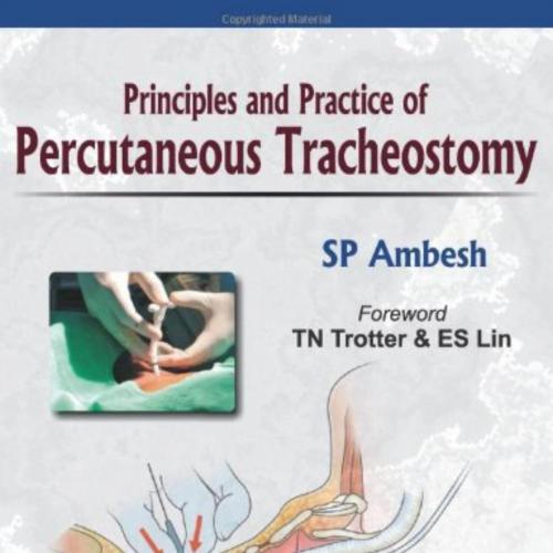 Principles and Practice of Percutaneous Tracheostomy