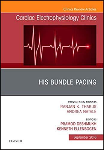 His Bundle Pacing