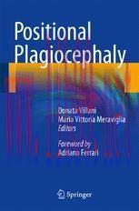[PDF]Positional Plagiocephaly