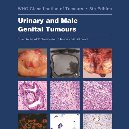 Urinary and Male Genital Tumours (WHO Classification of Tumours, 8) 5th Edition