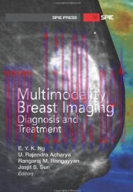 [AME]Multimodality Breast Imaging: Diagnosis and Treatment