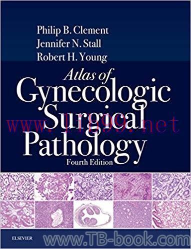 Atlas of Gynecologic Surgical Pathology 4th Edition by Philip B. Clement
