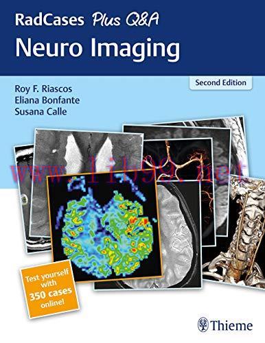 [AME]RadCases Plus Q&A Neuro Imaging, 2nd Edition (Original PDF)