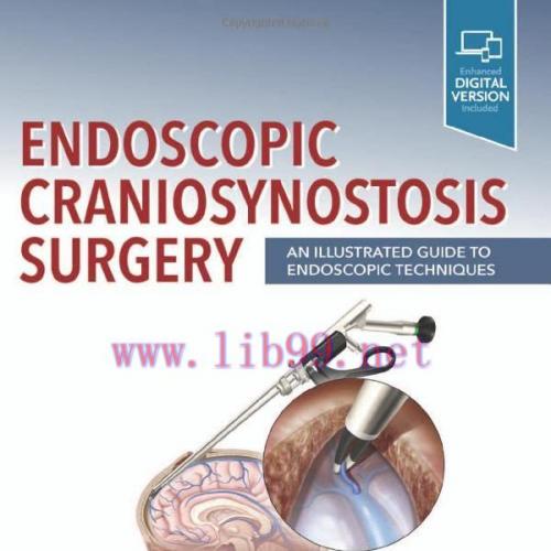 [AME]Endoscopic Craniosynostosis Surgery: An Illustrated Guide to Endoscopic Techniques (True P...