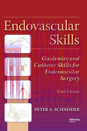 [AME]Endovascular Skills: Guidewire and Catheter Skills for Endovascular Surgery, Third Edition...