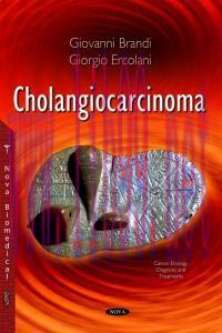 [AME]Cholangiocarcinoma