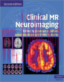 [AME]Clinical MR Neuroimaging: Physiological and Functional Techniques, 2nd Edition