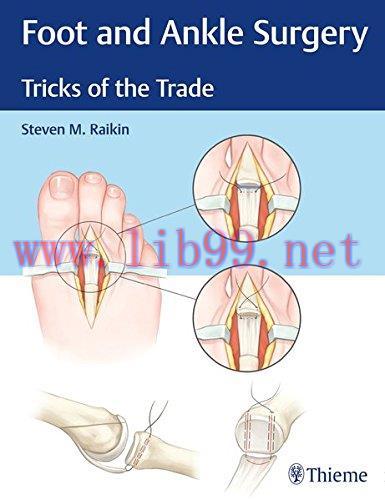 [AME]Foot and Ankle Surgery: Tricks of the Trade (EPUB)