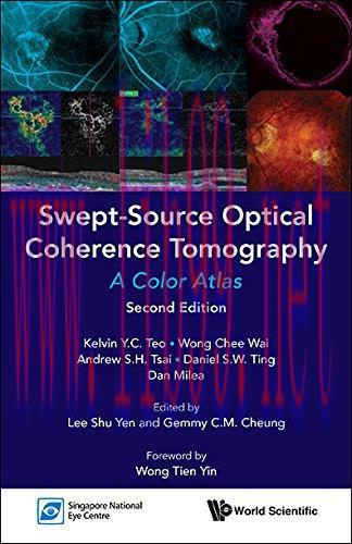 [AME]Swept-Source Optical Coherence Tomography: A Color Atlas (PDF)