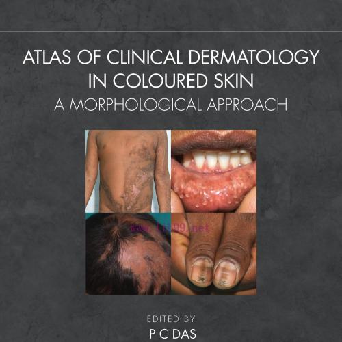 [AME]Atlas of Clinical Dermatology in Coloured Skin (EPUB)