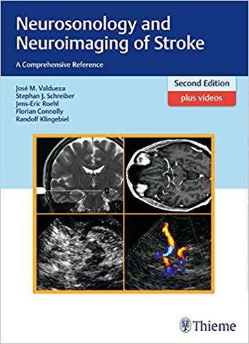 Neurosonology and Neuroimaging of Stroke, 2nd Edition + 1st Edition + Videos