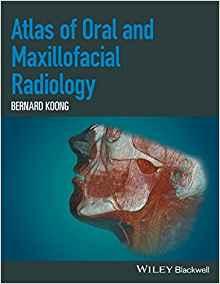 Atlas of Oral and Maxillofacial Radiology