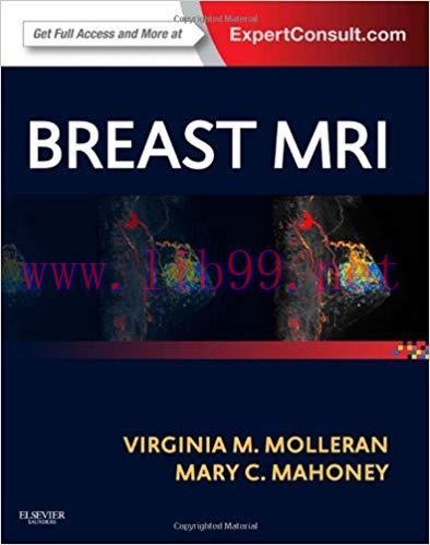 [PDF]Breast MRI - Expert Consult Online