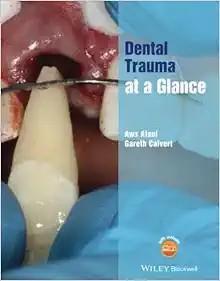 [AME]Dental Trauma at a Glance (At a Glance (Dentistry)) (Original PDF)